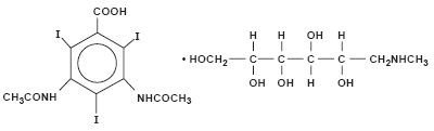 Hypaque Sodium 20%